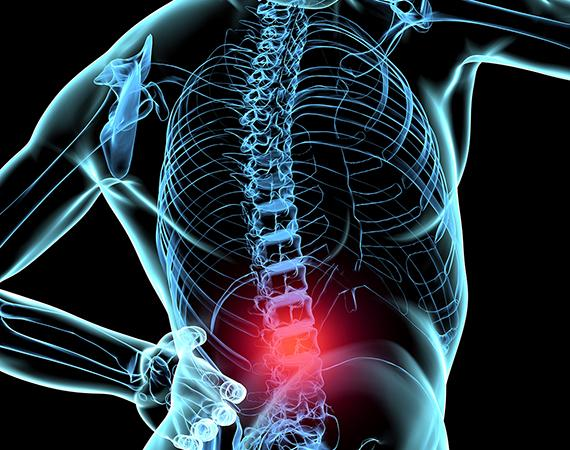 Neuropatia Diabética